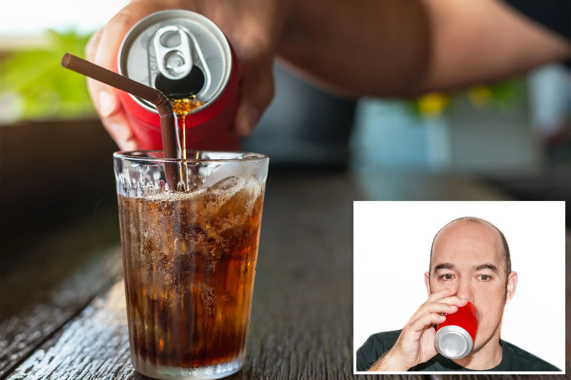 The Bitter Truth: Sugary Drinks and Hair Loss in Men