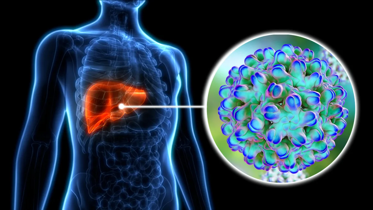 Hepatitis D liver cancer risk
